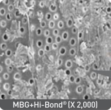 resto_hi-bond07.jpg