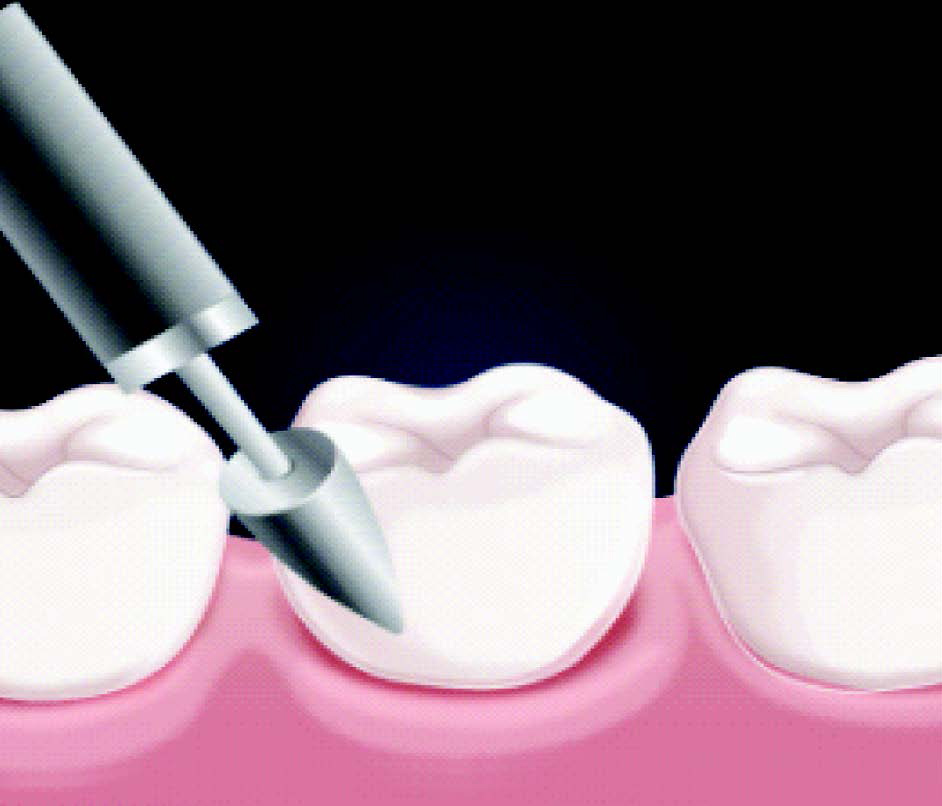 tempo_any-cem-implant05.jpg