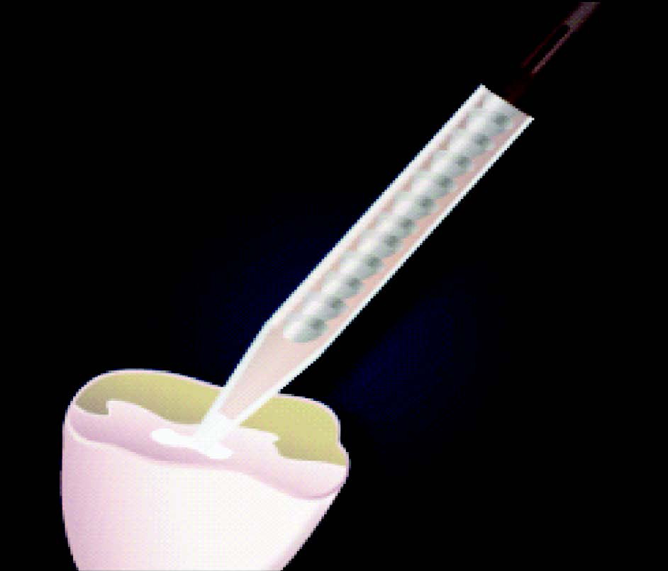 tempo_any-cem-implant03.jpg