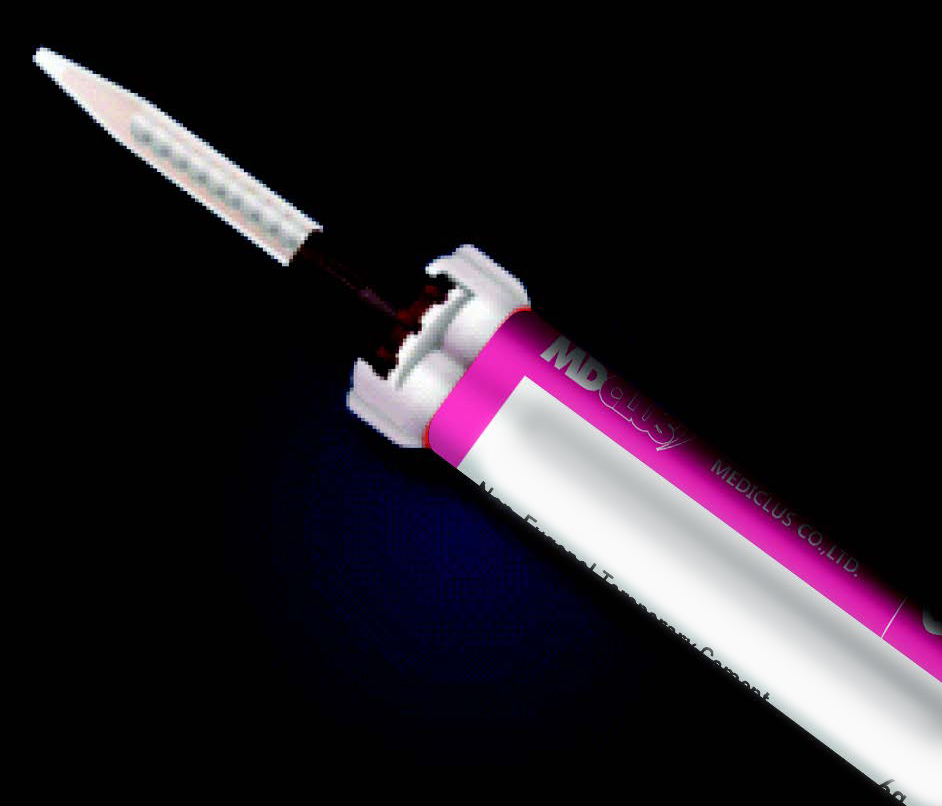 tempo_any-cem-implant02.jpg