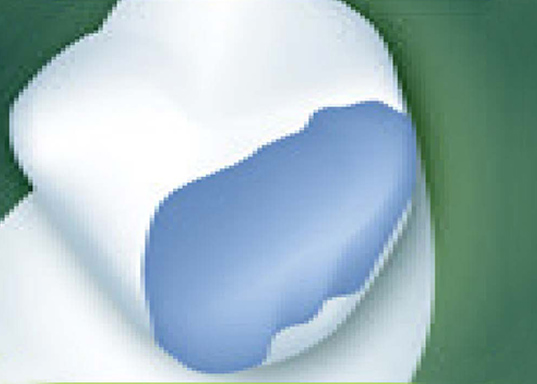 others_the-bloch-out-resin01.jpg